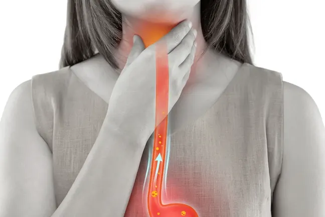 Reflux